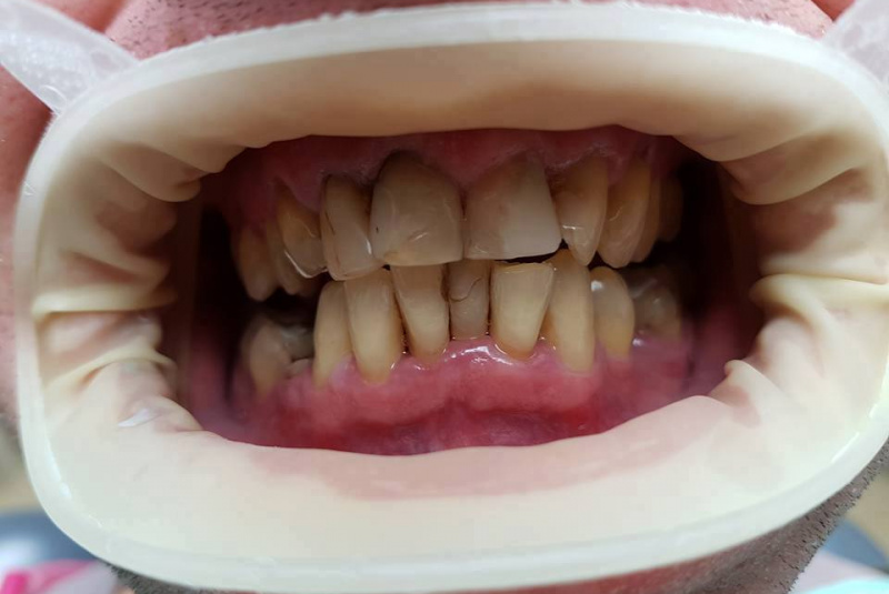  Premeny / Premeny - foto