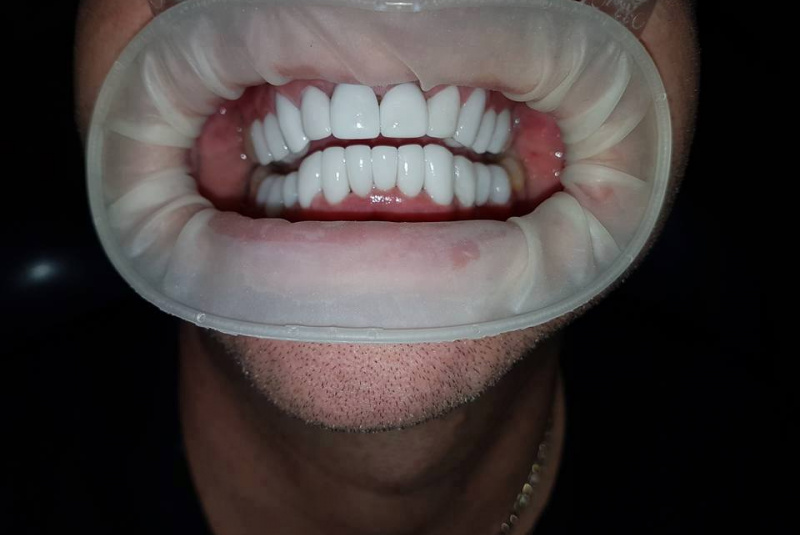  Premeny / Premeny - foto