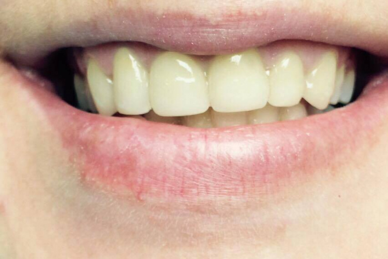  Premeny / Premeny - foto