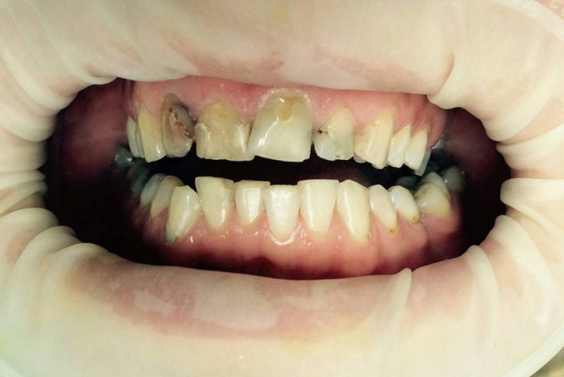  Premeny / Premeny - foto