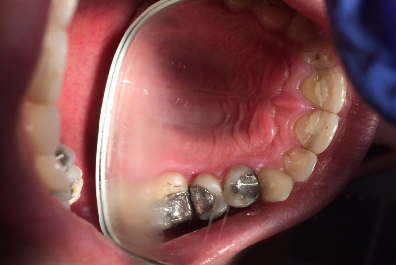  Premeny / Premeny - foto