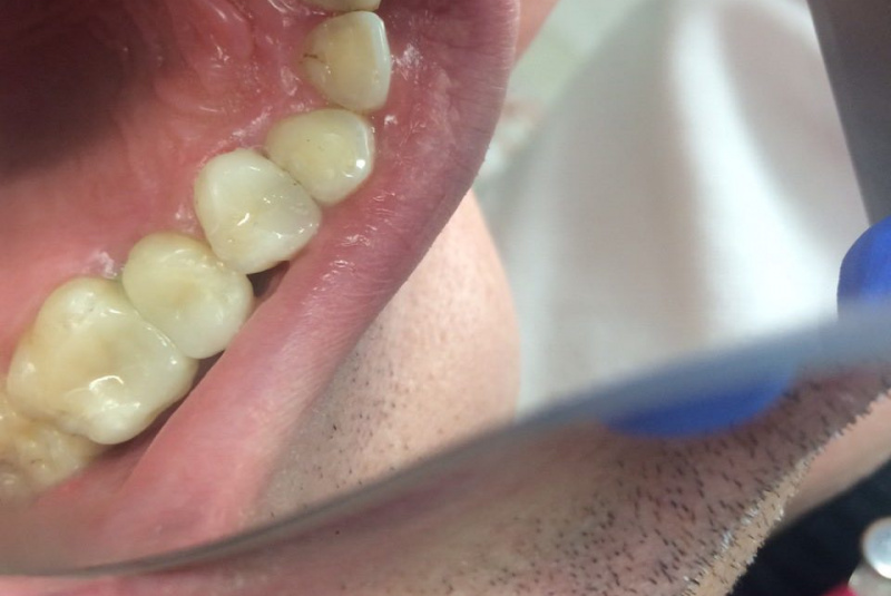  Premeny / Premeny - foto