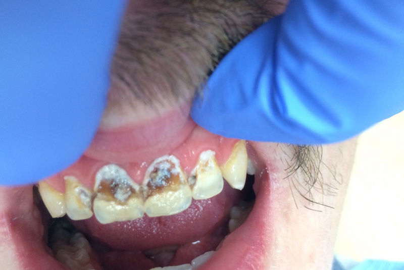  Premeny / Premeny - foto