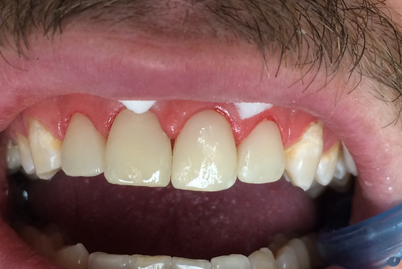  Premeny / Premeny - foto