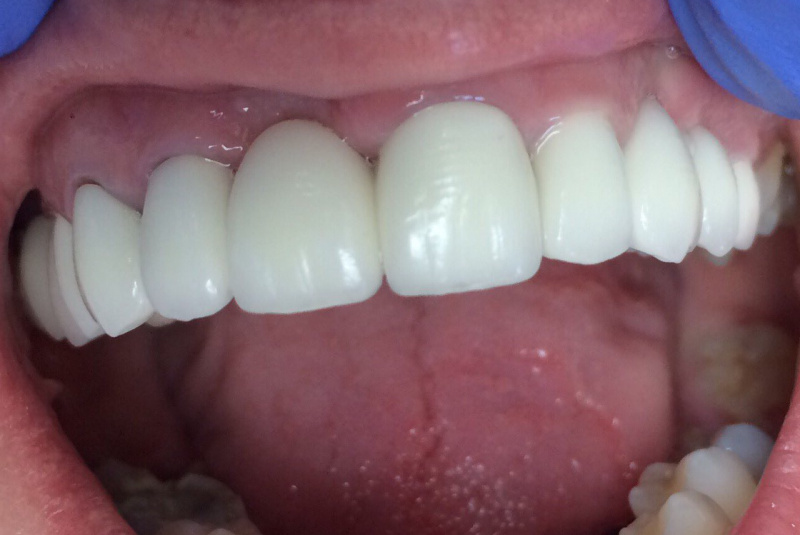  Premeny / Premeny - foto