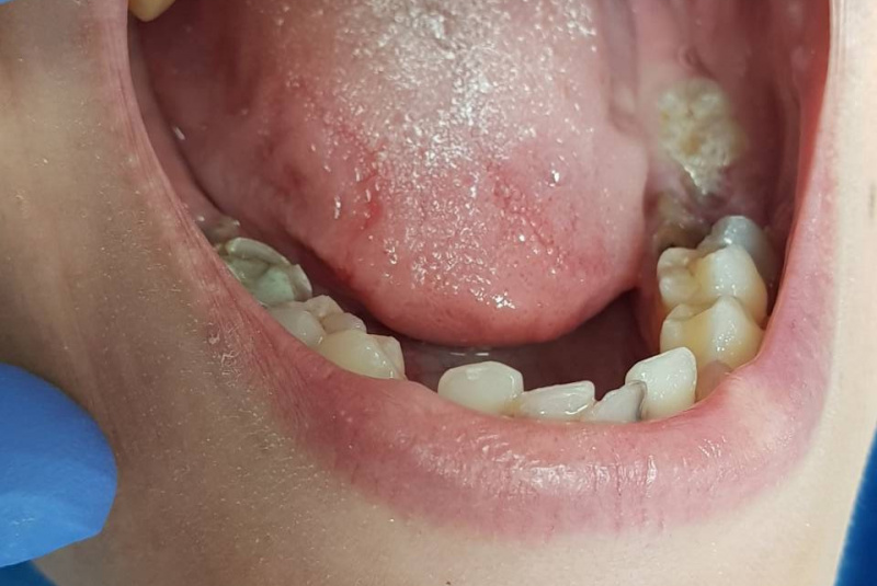  Premeny / Premeny - foto