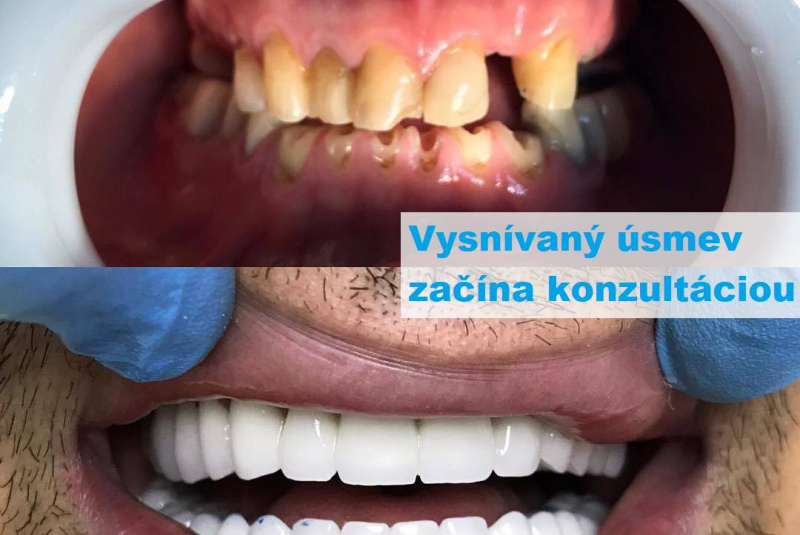  Premeny / Premeny - foto