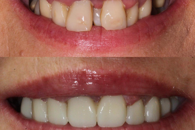  Premeny / Premeny - foto