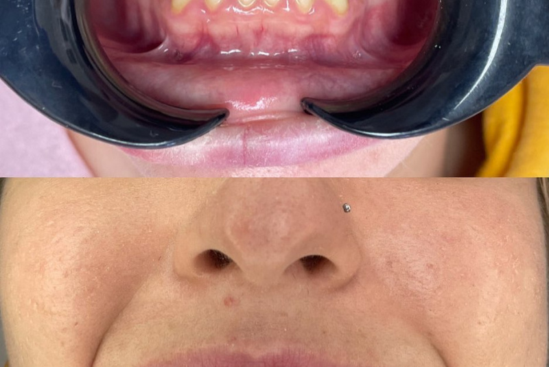  Premeny / Premeny - foto