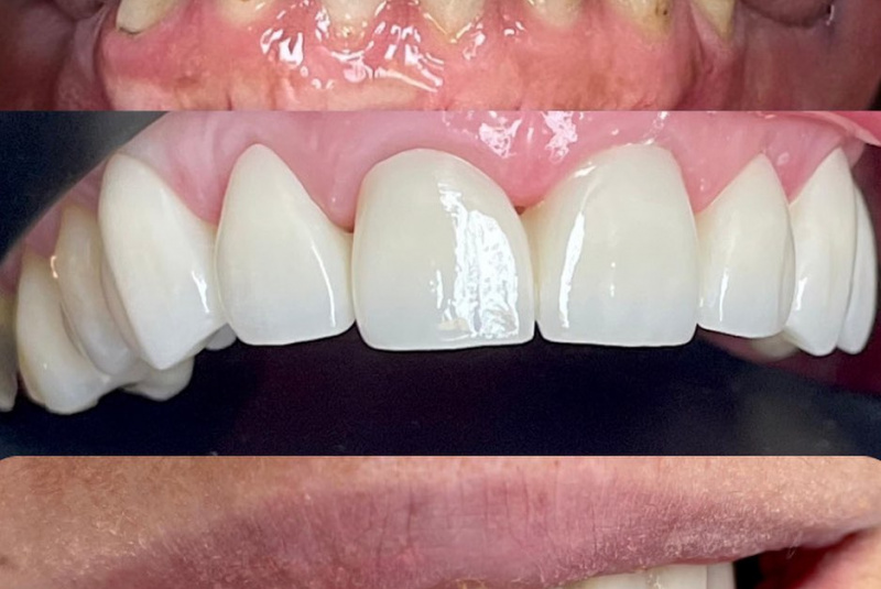  Premeny / Premeny - foto