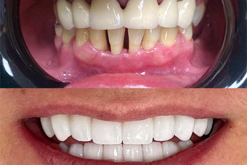  Premeny / Premeny - foto