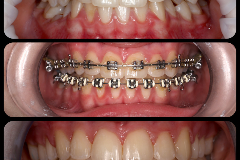  Premeny / Premeny so zubným strojčekom  - foto