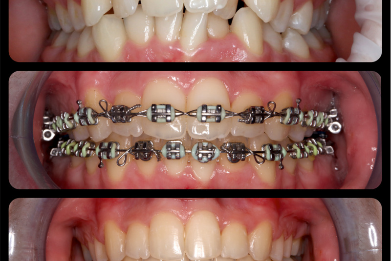  Premeny / Premeny so zubným strojčekom  - foto