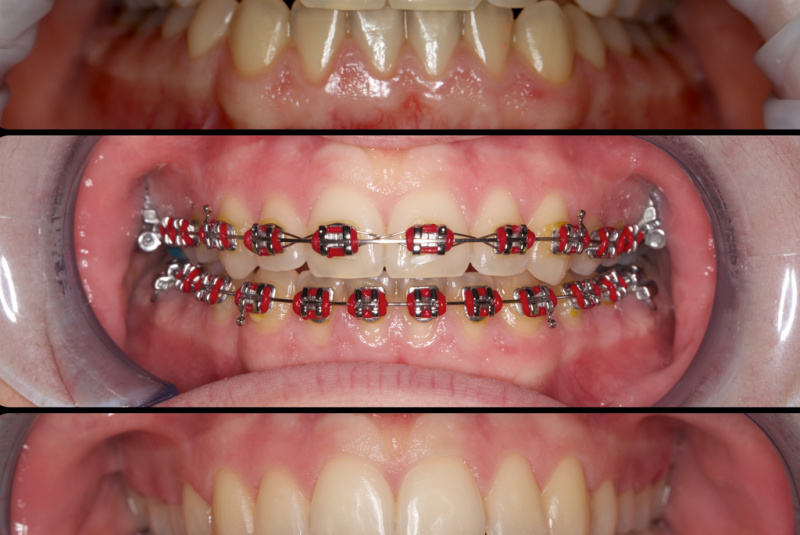  Premeny / Premeny so zubným strojčekom  - foto