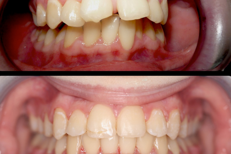  Premeny / Premeny so zubným strojčekom  - foto