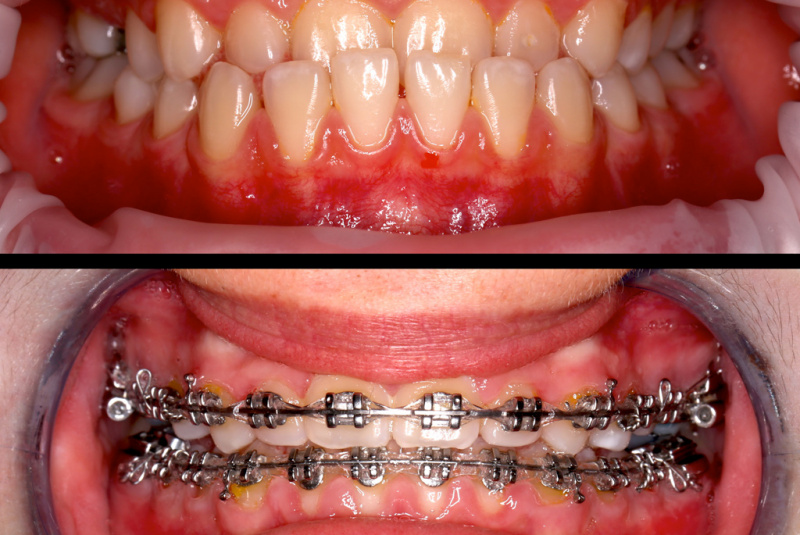  Premeny / Premeny so zubným strojčekom  - foto