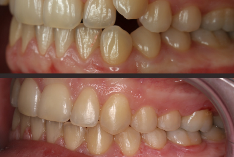  Premeny / Premeny so zubným strojčekom  - foto