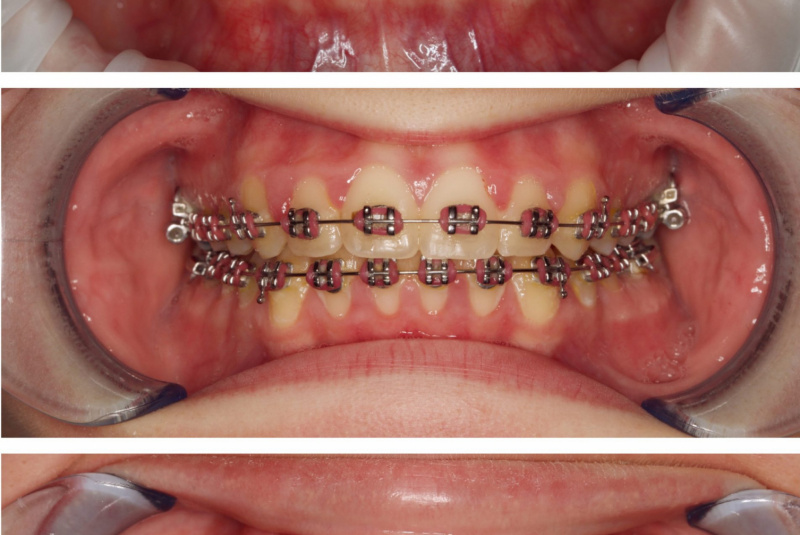  Premeny / Premeny so zubným strojčekom  - foto